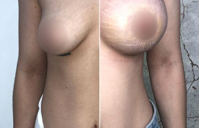 img-cx-mamaria img-cx-mamaria